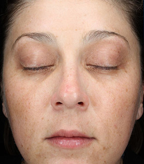 Woman with brighter complexion and reduced fine lines