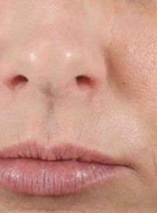 Woman's nose and mouth area with less visible lines and pores